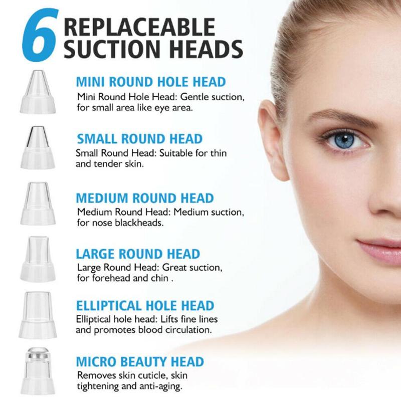 Electric Blackhead Remover - Pore Vacuum Cleaner