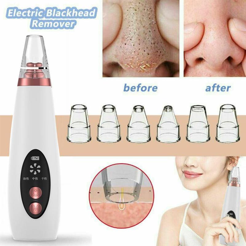 Electric Blackhead Remover - Pore Vacuum Cleaner