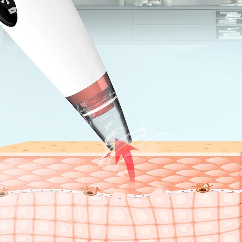 Electric Blackhead Remover - Pore Vacuum Cleaner
