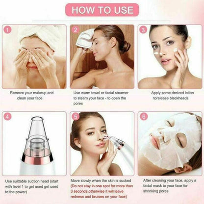 Electric Blackhead Remover - Pore Vacuum Cleaner